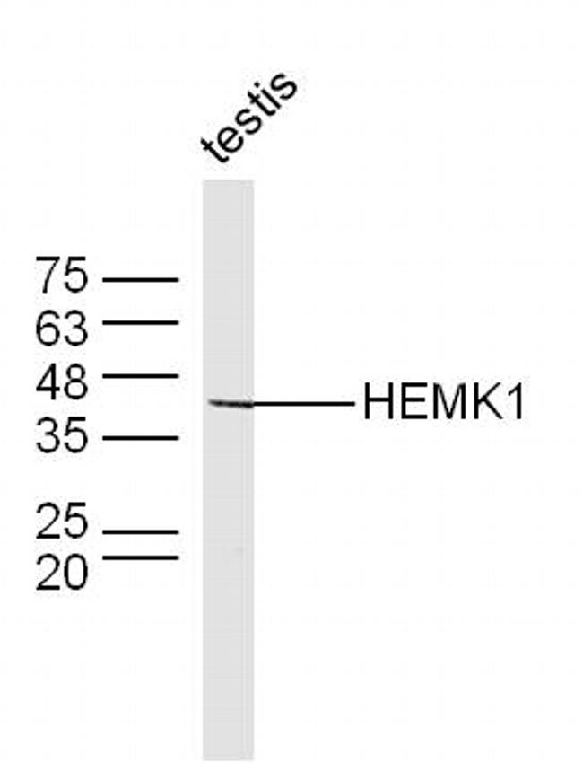 HEMK1 Antibody in Western Blot (WB)