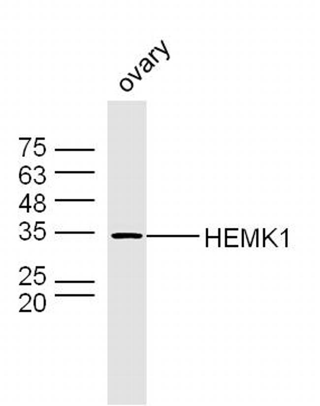 HEMK1 Antibody in Western Blot (WB)