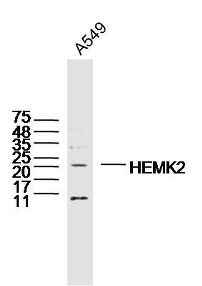 HEMK2 Antibody in Western Blot (WB)