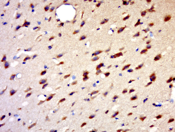 HENMT1 Antibody in Immunohistochemistry (Paraffin) (IHC (P))