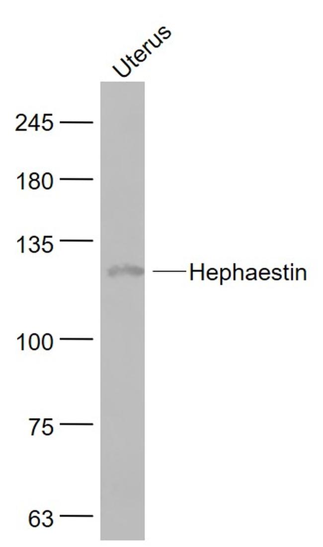 Hephaestin Antibody in Western Blot (WB)