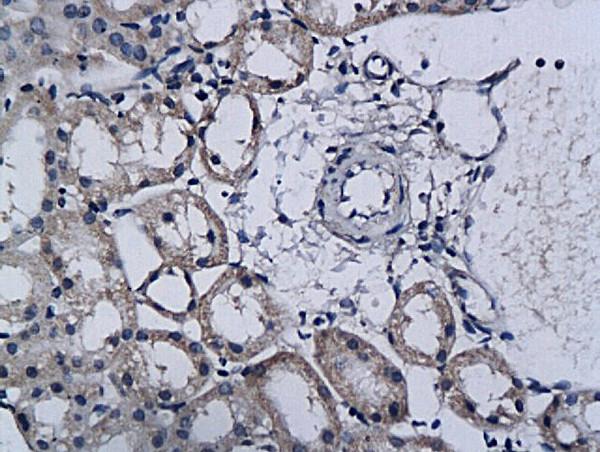 TPA Antibody in Immunohistochemistry (Paraffin) (IHC (P))