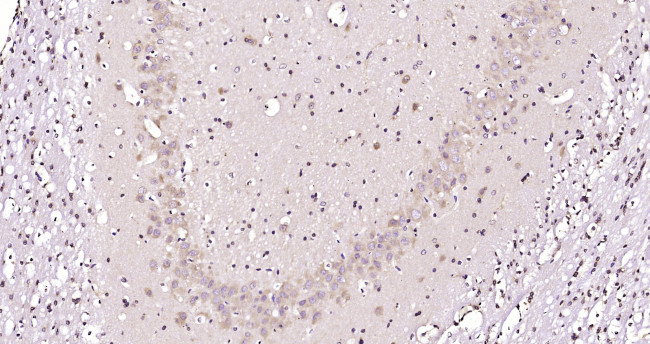 HERPUD1 Antibody in Immunohistochemistry (Paraffin) (IHC (P))