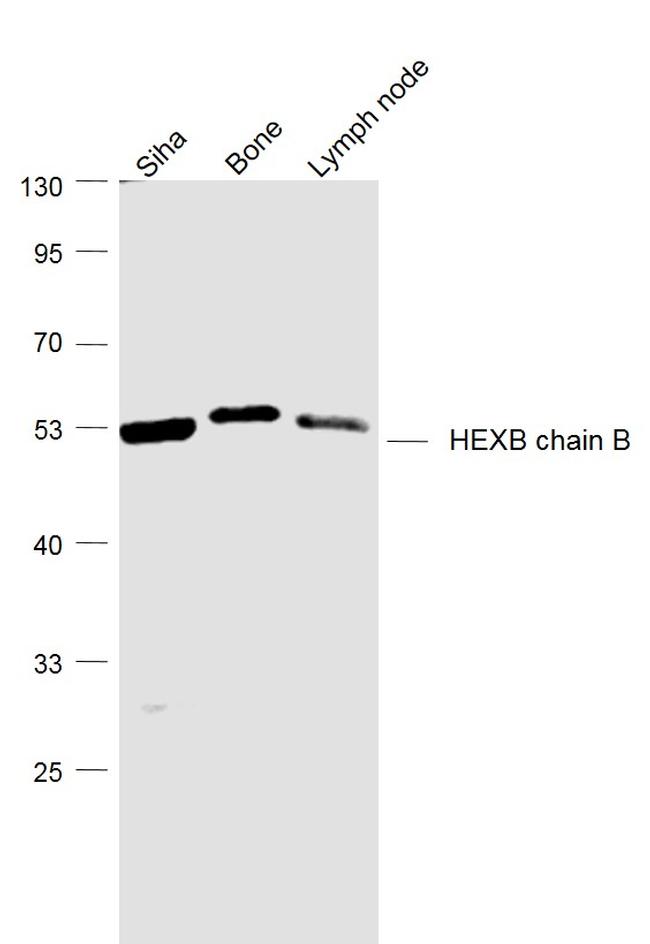HEXB chain B Antibody in Western Blot (WB)