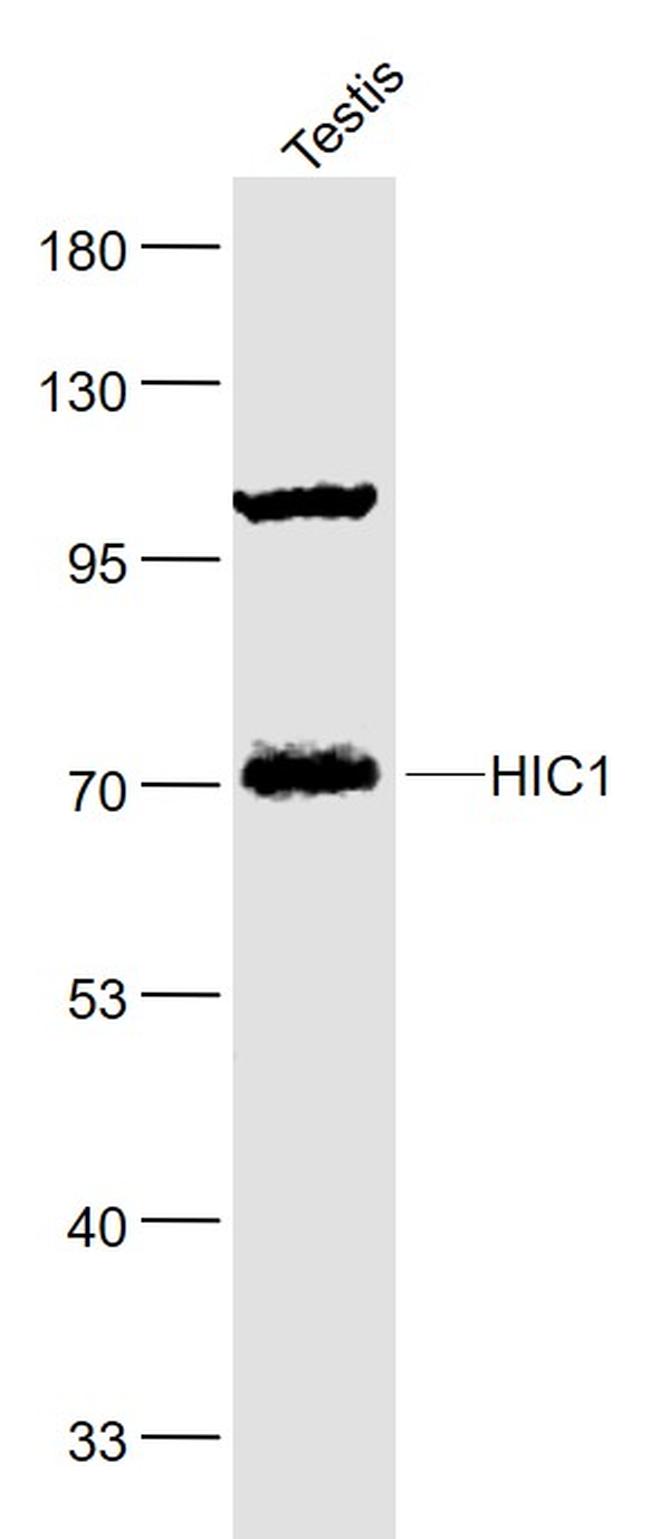 HIC1 Antibody in Western Blot (WB)