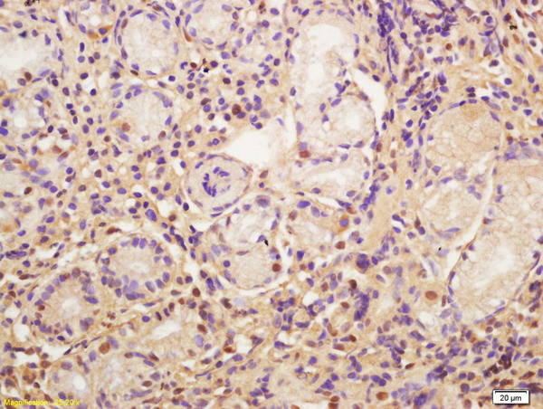 CDC5L Antibody in Immunohistochemistry (Paraffin) (IHC (P))