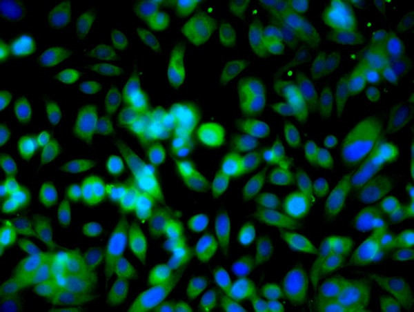 Ubiquitin Antibody in Immunocytochemistry (ICC/IF)