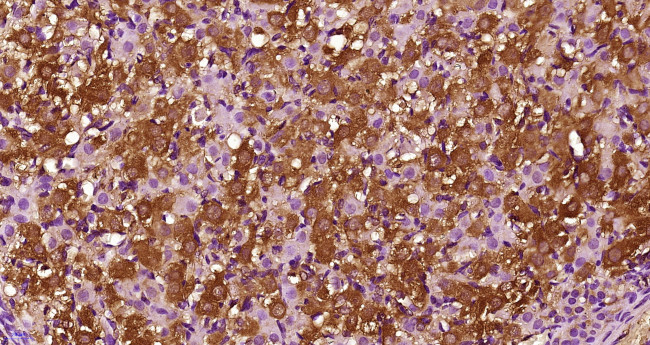 CCL26 Antibody in Immunohistochemistry (Paraffin) (IHC (P))