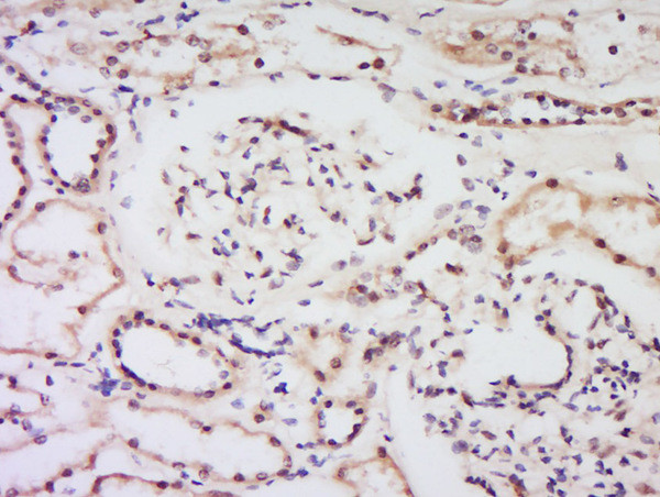 Bcl-2 Antibody in Immunohistochemistry (Paraffin) (IHC (P))