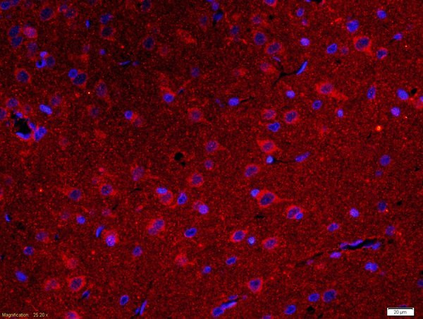 IDUA Antibody in Immunohistochemistry (Paraffin) (IHC (P))