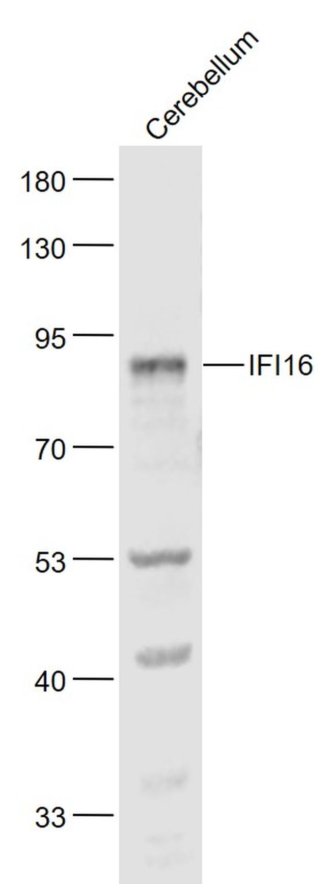 I16 Antibody in Western Blot (WB)