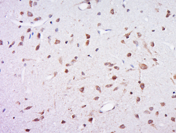 Profilin 1 Antibody in Immunohistochemistry (Paraffin) (IHC (P))