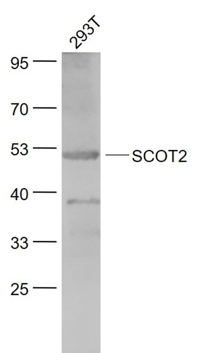 SCOT2 Antibody in Western Blot (WB)