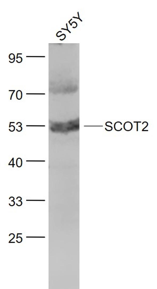 SCOT2 Antibody in Western Blot (WB)