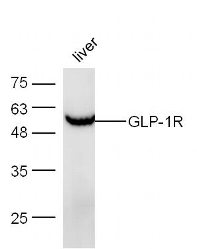 GLP-1R Antibody in Western Blot (WB)