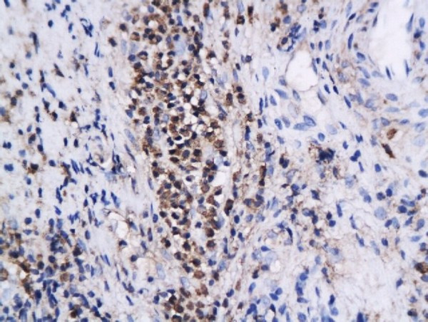 Annexin A1 Antibody in Immunohistochemistry (Paraffin) (IHC (P))