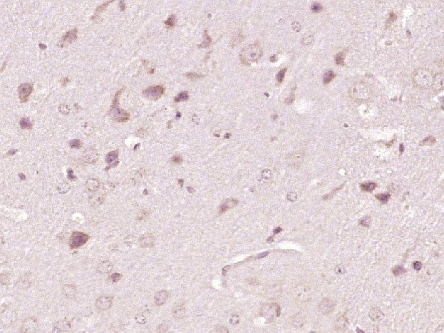 ATP7A Antibody in Immunohistochemistry (Paraffin) (IHC (P))