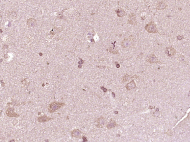 ATP7A Antibody in Immunohistochemistry (Paraffin) (IHC (P))