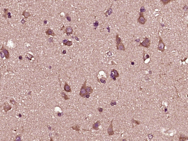 IFNA8 Antibody in Immunohistochemistry (Paraffin) (IHC (P))