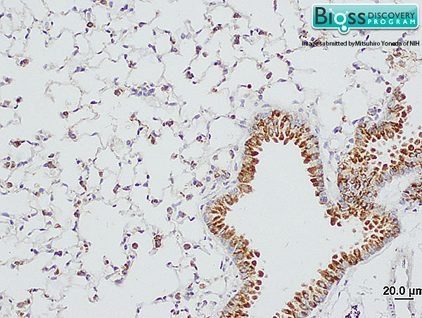 SP-D/PSPD Antibody in Immunohistochemistry (Paraffin) (IHC (P))