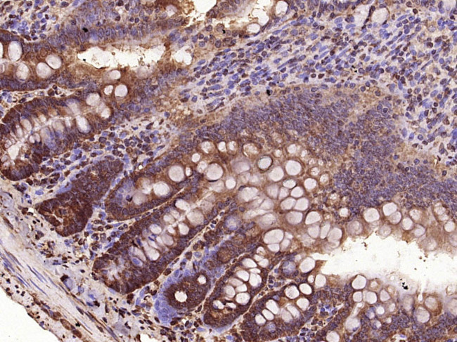 VEGF-C Antibody in Immunohistochemistry (Paraffin) (IHC (P))