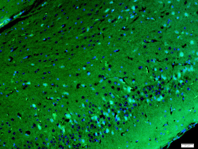 Gamma-Adaptin Antibody in Immunohistochemistry (Paraffin) (IHC (P))