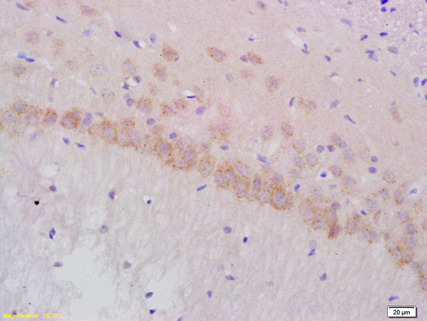 Gamma-Adaptin Antibody in Immunohistochemistry (Paraffin) (IHC (P))