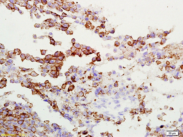 Gamma-Adaptin Antibody in Immunohistochemistry (Paraffin) (IHC (P))