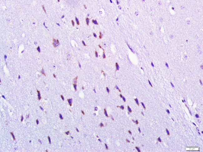 Gamma-Adaptin Antibody in Immunohistochemistry (Paraffin) (IHC (P))