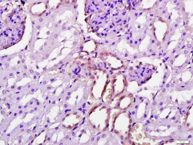 Gamma-Adaptin Antibody in Immunohistochemistry (Paraffin) (IHC (P))