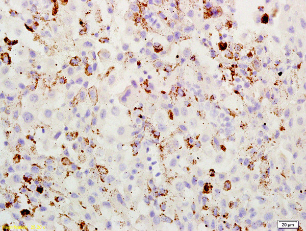 ABCB5 Antibody in Immunohistochemistry (Paraffin) (IHC (P))