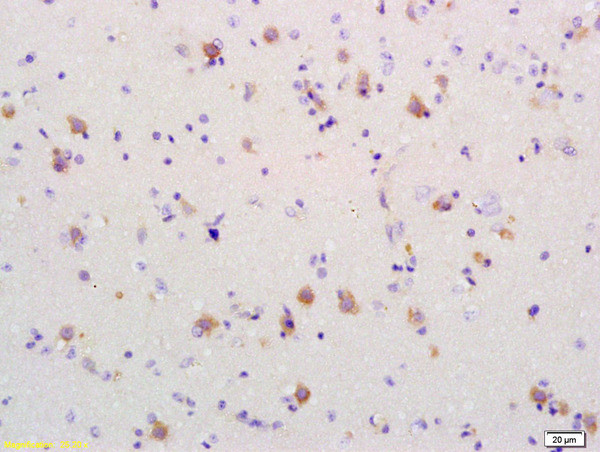 PDCD4 Antibody in Immunohistochemistry (Paraffin) (IHC (P))