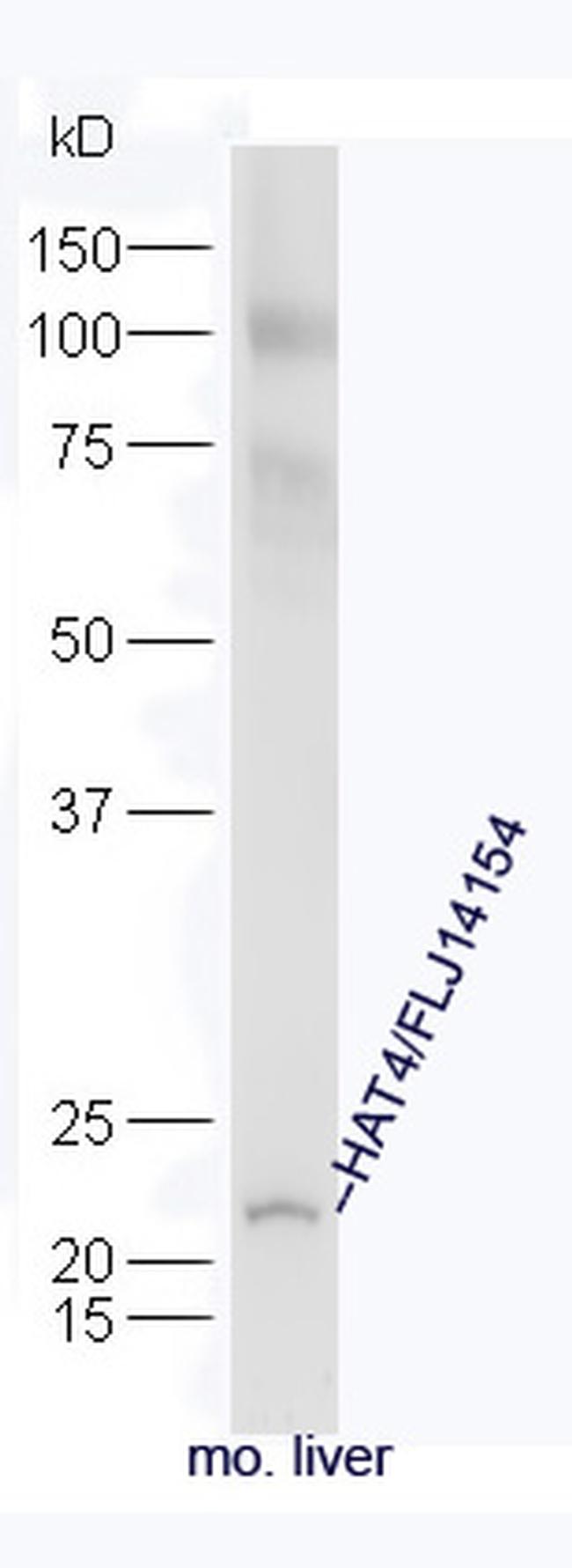 HAT4 Antibody in Western Blot (WB)