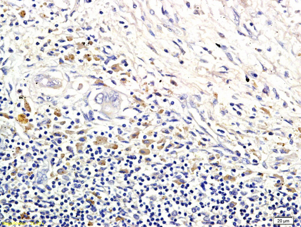 LI-cadherin Antibody in Immunohistochemistry (Paraffin) (IHC (P))