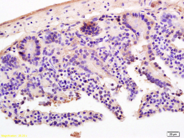 LI-cadherin Antibody in Immunohistochemistry (Paraffin) (IHC (P))