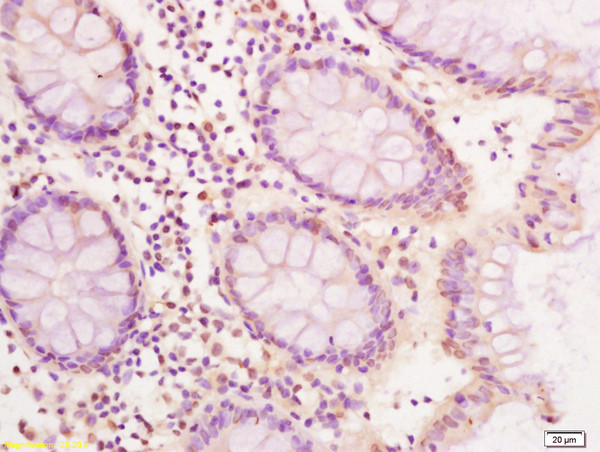 CDX2 Antibody in Immunohistochemistry (Paraffin) (IHC (P))