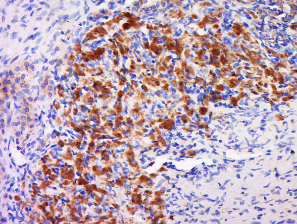 GAL3ST4 Antibody in Immunohistochemistry (Paraffin) (IHC (P))