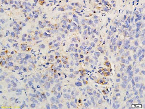 CXCR2/CD182 Antibody in Immunohistochemistry (Paraffin) (IHC (P))