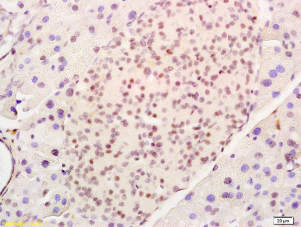 CEBP-alpha Antibody in Immunohistochemistry (Paraffin) (IHC (P))