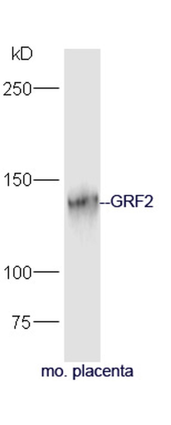 GRF2 Antibody in Western Blot (WB)