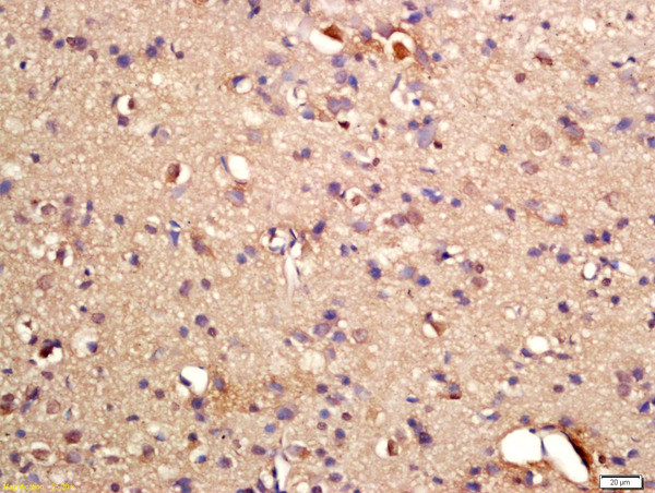 Phospho-GRLF1 (Tyr1087) Antibody in Immunohistochemistry (Paraffin) (IHC (P))