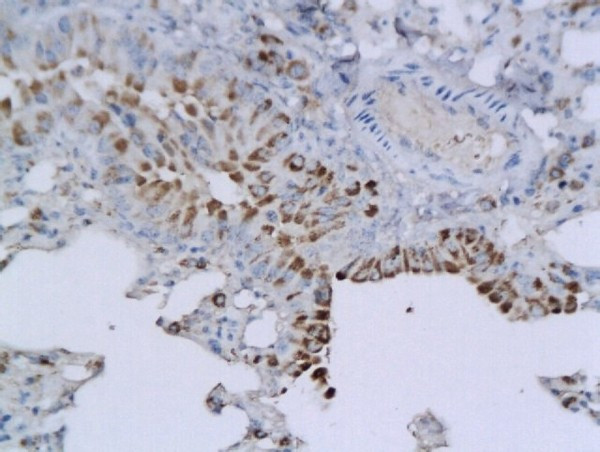 B3GAT1/CD57 Antibody in Immunohistochemistry (Paraffin) (IHC (P))