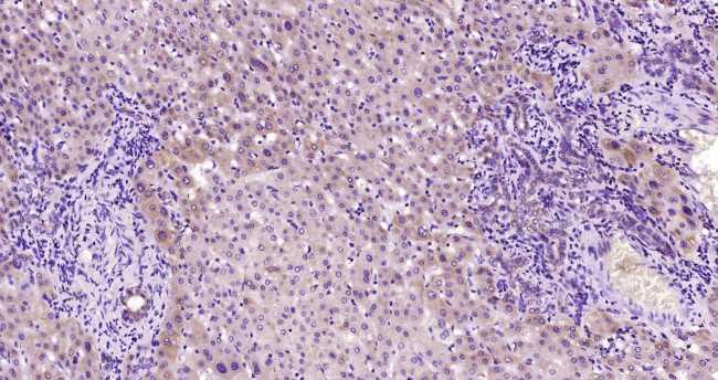 Antithrombin 3 Antibody in Immunohistochemistry (Paraffin) (IHC (P))