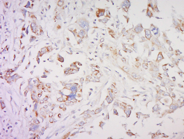 SMAD1 Antibody in Immunohistochemistry (Paraffin) (IHC (P))