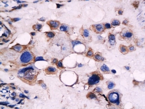 CD59 Antibody in Immunohistochemistry (Paraffin) (IHC (P))