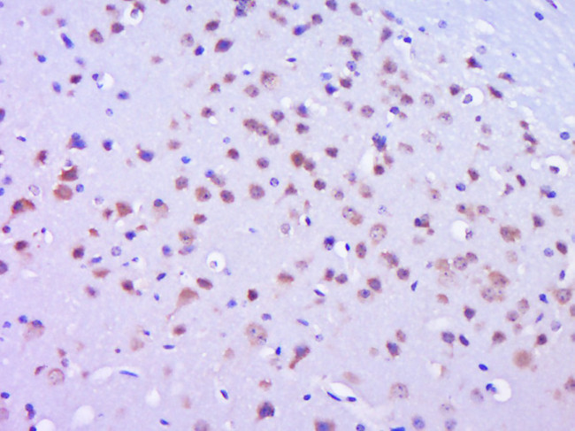 Phospho-FAK (Tyr577) Antibody in Immunohistochemistry (Paraffin) (IHC (P))