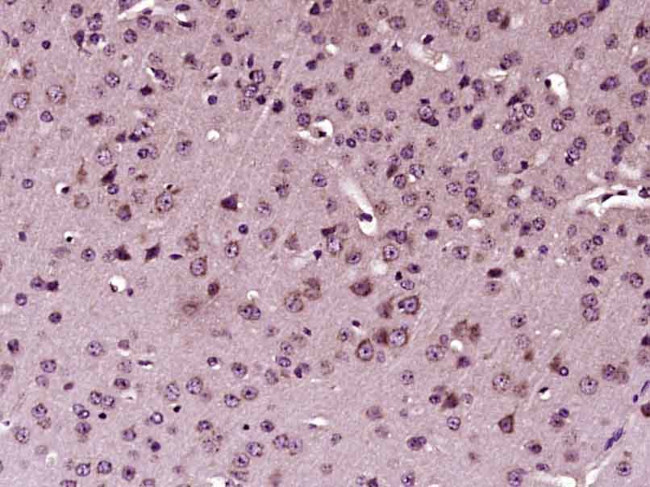 Phospho-STAT1 (Tyr701) Antibody in Immunohistochemistry (Paraffin) (IHC (P))