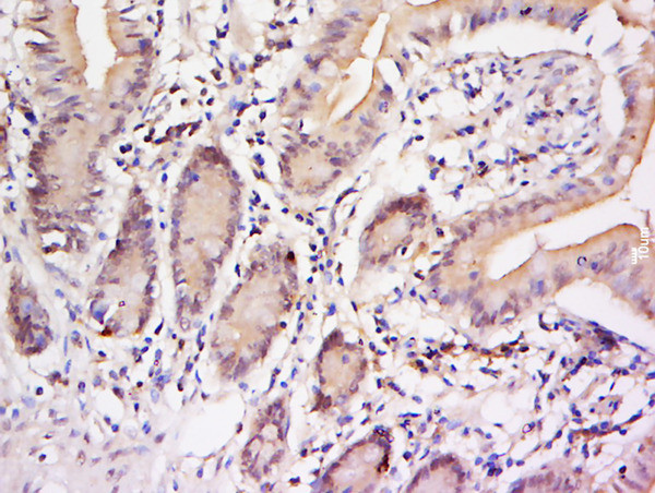 Phospho-STAT3 (Tyr705) Antibody in Immunohistochemistry (Paraffin) (IHC (P))