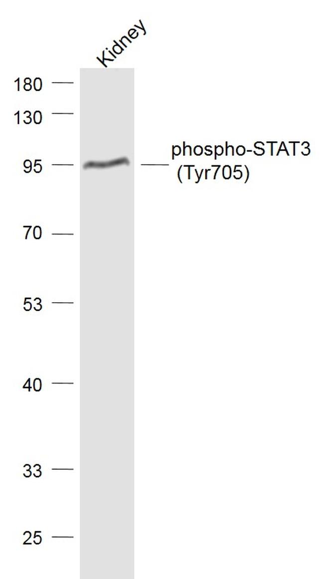 Phospho-STAT3 (Tyr705) Antibody in Western Blot (WB)