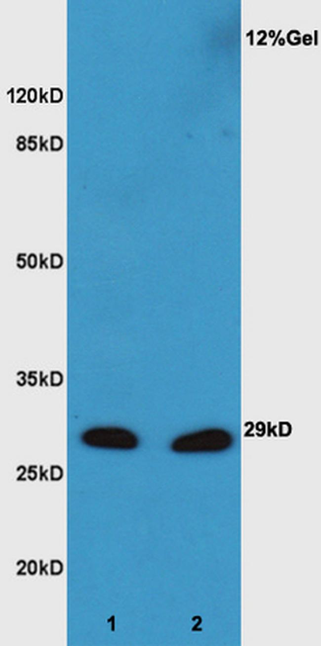 XBP1 Antibody in Western Blot (WB)